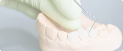 L’implant unitaire au cabinet dentaire du dr Cristian Kelemen